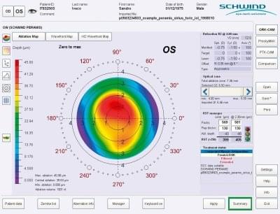 Dr Jimmy Lim JL Eye Specialists SCHWIND CAM module ORK-CAM treatment planning chart full